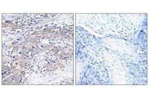 Immunohistochemistry analysis of paraffin-embedded human cervix tissue using CLN6 antibody. (CLN6 抗体)