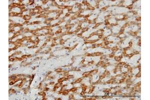 Image no. 1 for anti-Translocase of Inner Mitochondrial Membrane 8A (TIMM8A) (AA 9-98) antibody (ABIN598643) (TIMM8A/DDP 抗体  (AA 9-98))