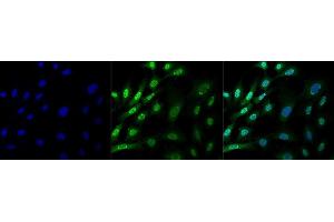 Immunocytochemistry/Immunofluorescence analysis using Mouse Anti-Ubiquitin Monoclonal Antibody, Clone FK1 (ABIN5024473). (Ubiquitin 抗体  (HRP))