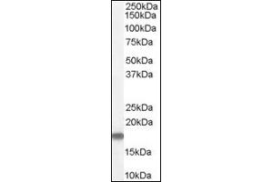 Image no. 1 for anti-Stathmin 1 (STMN1) (C-Term) antibody (ABIN374648) (Stathmin 1 抗体  (C-Term))