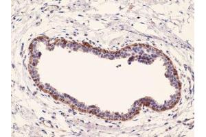 Immunohistochemistry (IHC) image for anti-Keratin 17 (KRT17) (C-Term) antibody (ABIN870563) (KRT17 抗体  (C-Term))