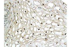 Formalin-fixed and paraffin embedded human cervical tissue labeled with Anti-XBP-1 Polyclonal Antibody, Unconjugated (ABIN732728) followed by conjugation to the secondary antibody and DAB staining (XBP1 抗体  (AA 51-150))