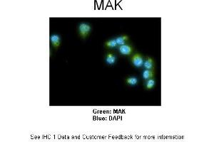 Sample Type :  Human lung adenocarcinoma cell line A549  Primary Antibody Dilution :  1:100  Secondary Antibody :  Goat anti-rabbit AlexaFluor 488  Secondary Antibody Dilution :  1:400  Color/Signal Descriptions :  MAK: Green DAPI:Blue  Gene Name :  MAK   Submitted by :  Dr. (MAK 抗体  (C-Term))