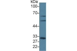 Detection of GCLM in Human A431 cell lysate using Polyclonal Antibody to Glutamate Cysteine Ligase, Modifier Subunit (GCLM) (GCLM 抗体  (AA 40-251))