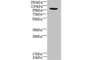 Western blot All lanes: PPFIBP2 antibody at 6 μg/mL + HepG2 whole cell lysate Secondary Goat polyclonal to rabbit at 1/10000 dilution Predicted band size: 99, 87, 84 kDa Observed band size: 99 kDa (PPFIBP2 抗体  (AA 101-400))