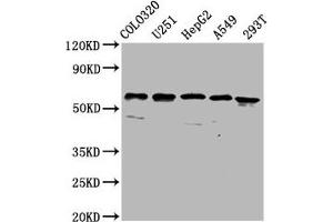 Western Blot Positive WB detected in: Colo320 whole cell lysate, U251 whole cell lysate, HepG2 whole cell lysate, A549 whole cell lysate, 293T whole cell lysate All lanes: CLCC1 antibody at 3. (CLCC1 抗体  (AA 446-551))