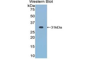 Detection of Recombinant HDAC6, Mouse using Polyclonal Antibody to Histone Deacetylase 6 (HDAC6) (HDAC6 抗体  (AA 560-811))