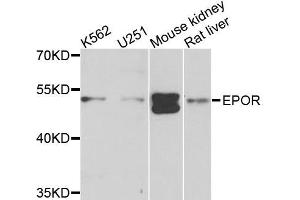 Western blot analysis of extracts of various cells, using EPOR antibody. (EPOR 抗体)