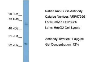WB Suggested Anti-BBS4  Antibody Titration: 0. (BBS4 抗体  (N-Term))