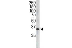 Western Blotting (WB) image for anti-C-Fos Induced Growth Factor (Vascular Endothelial Growth Factor D) (Figf) (C-Term), (N-Term) antibody (ABIN3029816)