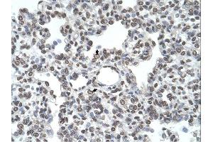 TMPRSS11D antibody was used for immunohistochemistry at a concentration of 4-8 ug/ml. (TMPRSS11D 抗体  (N-Term))