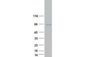 Western Blotting (WB) image for tRNA-splicing Endonuclease Subunit SEN2 (TSEN2) (Transcript Variant 1) protein (Myc-DYKDDDDK Tag) (ABIN2734438)