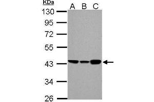 WB Image ACADM antibody detects ACADM protein by Western blot analysis. (Medium-Chain Specific Acyl-CoA Dehydrogenase, Mitochondrial (Center) 抗体)