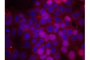 Immunofluorescence staining of methanol-fixed MCF-7 cells using Phospho-ESR1-S106 antibody (ABIN2988004). (Estrogen Receptor alpha 抗体  (pSer106))