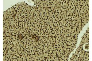 ABIN6276974 at 1/100 staining Mouse liver tissue by IHC-P. (SMAD5 抗体  (Internal Region))