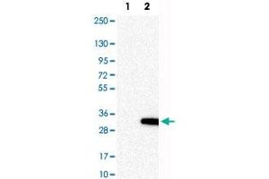 Western Blot analysis of Lane 1: negative control (vector only transfected HEK293T cell lysate) and Lane 2: over-expression lysate (co-expressed with a C-terminal myc-DDK tag in mammalian HEK293T cells) with RASL11A polyclonal antibody . (RASL11A 抗体)