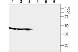 Western Blotting (WB) image for anti-Corticotropin Releasing Hormone Receptor 1 (CRHR1) (AA 31-44), (Extracellular) antibody (ABIN7043086)