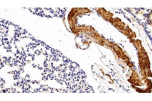 Immunohistochemistry (IHC) image for anti-Myoglobin (MB) (AA 1-154) antibody (ABIN7429604)
