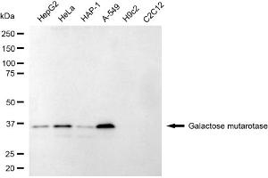 Western blotting analysis using galactose mutarotase antibody (ABIN7798681).