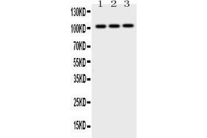 Western Blotting (WB) image for anti-Adaptor-Related Protein Complex 2, beta 1 Subunit (AP2B1) (AA 311-522) antibody (ABIN4886461)