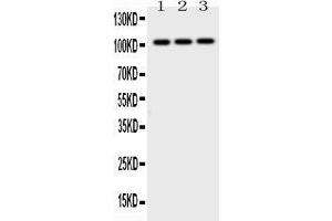 Western blot analysis of AP2B1 expression in rat testis extract ( Lane 1), mouse brain extract ( Lane 2) and MCF-7 whole cell lysates ( Lane 3). (AP2B1 抗体  (AA 311-522))