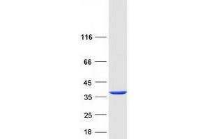 Western Blotting (WB) image for Tropomyosin 4 (TPM4) (Transcript Variant 2) protein (Myc-DYKDDDDK Tag) (ABIN2734395)