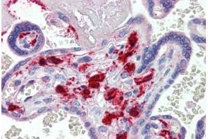 Human Placenta (formalin-fixed, paraffin-embedded) stained with F13A1 antibody ABIN462397 followed by biotinylated secondary antibody, alkaline phosphatase-streptavidin and chromogen. (F13A1 抗体)