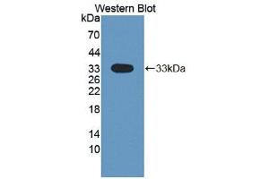 Western blot analysis of the recombinant protein. (DSTYK 抗体  (AA 650-904))