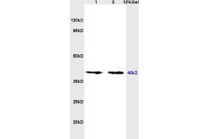 SDS-PAGE (SDS) image for anti-Opiate Receptor-Like 1 (OPRL1) (AA 1-47) antibody (ABIN725960)