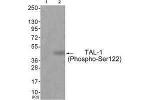 Western blot analysis of extracts from JK cells (Lane 2), using TAL-1 (Phospho-Ser122) Antibody.