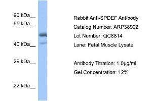 WB Suggested Anti-SPDEF Antibody   Titration: 1. (SPDEF/PSE 抗体  (C-Term))