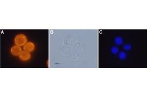 Expression of OX1R in human colon cancer cell lines - Immunocytochemical staining of paraformaldehyde fixed and permeabilized human Colo-205 colon cancer cells A. (HCRTR1 抗体  (AA 256-269))