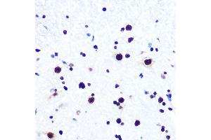 Immunohistochemistry of paraffin-embedded mouse spinal cord using DDX5 Rabbit mAb (ABIN7266698) at dilution of 1:100 (40x lens). (DDX5 抗体)