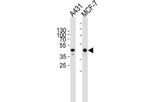 Western Blotting (WB) image for anti-Calcitonin Receptor (CALCR) antibody (ABIN3002412)