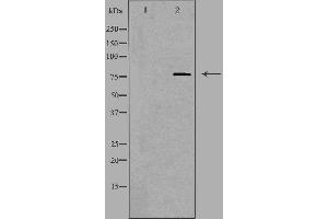 Western blot analysis of extracts from HUVEC, using SKIL antibody.