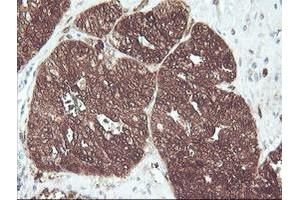 Image no. 7 for anti-CNDP Dipeptidase 2 (Metallopeptidase M20 Family) (CNDP2) antibody (ABIN1497548) (CNDP2 抗体)