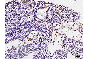 Formalin-fixed and paraffin embedded human spleen tissue labeled with Anti-RANK/CD265 Polyclonal Antibody, Unconjugated (ABIN749258) at 1:200 followed by conjugation to the secondary antibody, (SP-0023), and DAB staining (TNFRSF11A 抗体  (AA 51-150))