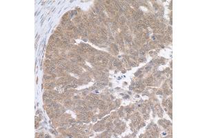 Immunohistochemistry (IHC) image for anti-Ribosomal Protein L5 (RPL5) (AA 247-297) antibody (ABIN7454984)