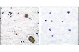 Immunohistochemistry analysis of paraffin-embedded human brain tissue, using GFR alpha-1 Antibody. (GFRA1 抗体  (AA 51-100))