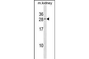 Western blot analysis in kidney cell line lysates (35ug/lane). (VPS25 抗体  (C-Term))