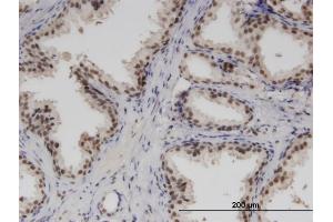 Immunoperoxidase of monoclonal antibody to RBM6 on formalin-fixed paraffin-embedded human prostate. (RBM6 抗体  (AA 1024-1123))