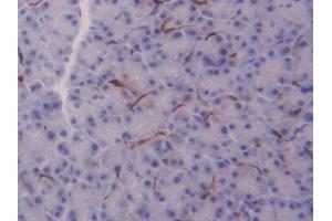 Immunohistochemistry (IHC) image for anti-Fatty Acid Binding Protein 4, Adipocyte (FABP4) (AA 2-132) antibody (ABIN7436912)