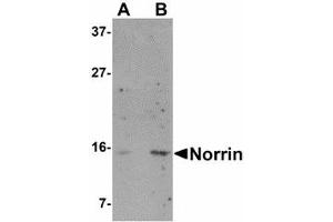 Image no. 1 for anti-Norrie Disease (Pseudoglioma) (NDP) (N-Term) antibody (ABIN478068) (Norrie Disease (Pseudoglioma) 抗体  (N-Term))