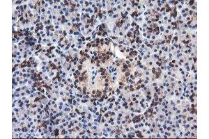 Image no. 1 for anti-F-Box Protein 21 (FBXO21) antibody (ABIN1498231) (FBXO21 抗体)