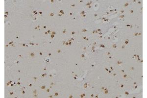 ABIN6277140 at 1/100 staining Human brain tissue by IHC-P. (ALOX5 抗体  (C-Term))