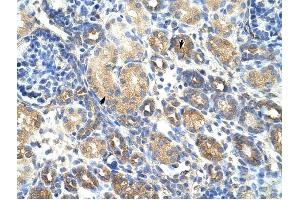 GNB1L antibody was used for immunohistochemistry at a concentration of 4-8 ug/ml to stain Epithelial cells of renal tubule (arrows) in Human Kidney.