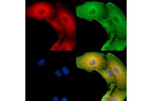 ABIN7096261 and ABIN7100323 staining  cells by IF/ICC. (SLC25A43 抗体)