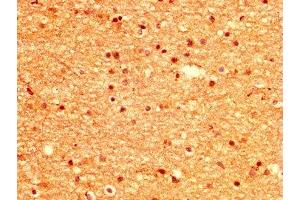 IHC image of ABIN7168378 diluted at 1:500 and staining in paraffin-embedded human brain tissue performed on a Leica BondTM system. (MSI1 抗体  (AA 221-347))