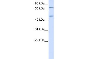 WB Suggested Anti-DDX1 Antibody Titration:  0. (DDX1 抗体  (N-Term))