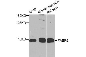 Western blot analysis of extracts of various cell lines, using FABP5 antibody.